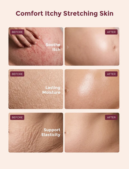 Pro-Collagen Belly Firming Stretch Mark Cream